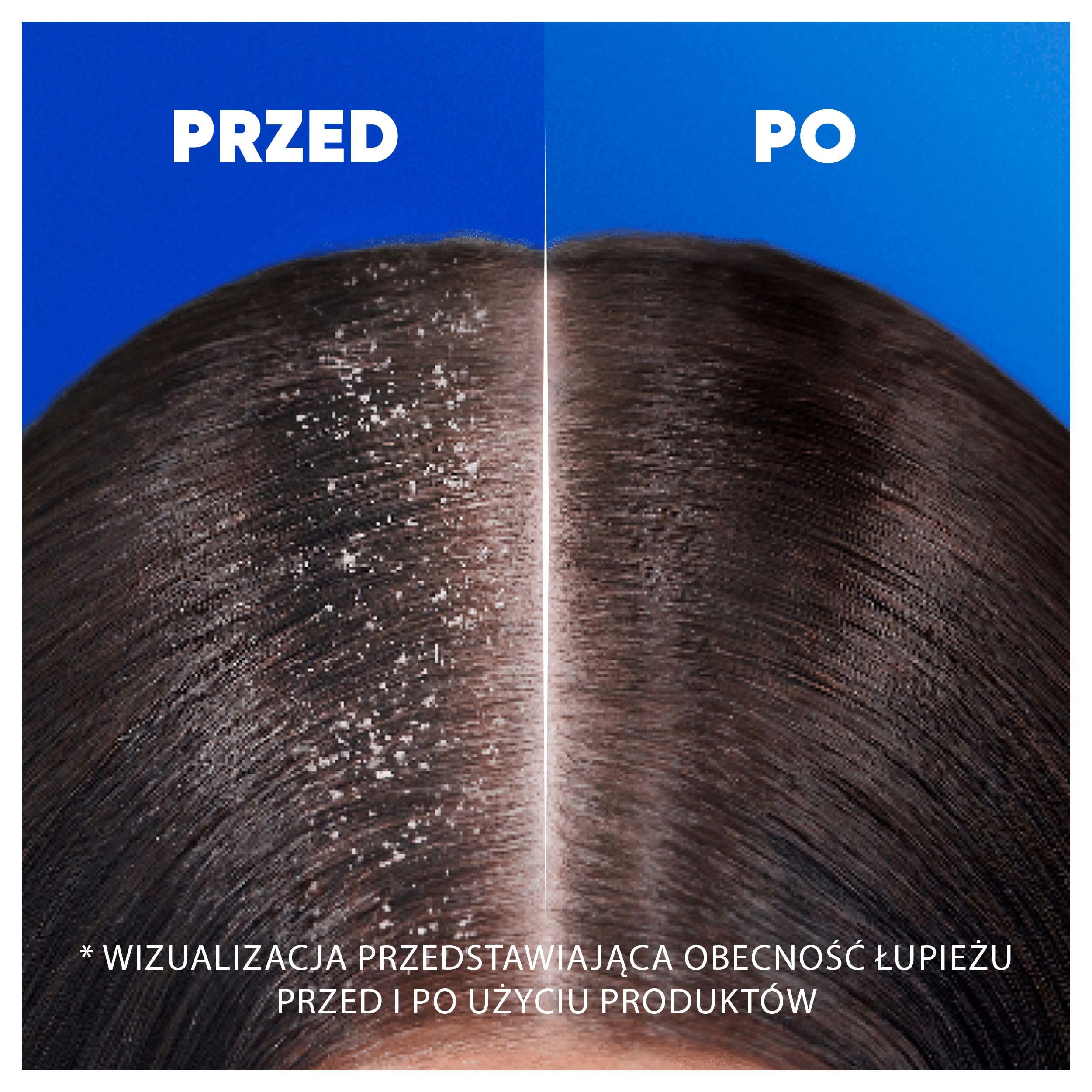 Head & Shoulders Classic Clean Codzienny Szampon Przeciwłupieżowy 400 ml, Ochrona przed Łupieżem do 100 procent, Potwierdzona Klinicznie, Dla Wszystkich Typów Włosów i Skóry Głowy, Efekt Świeżości
