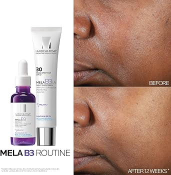 La Roche-Posay Mela B3 Koyu Leke Karşıtı Yüz Serumu 30 ml