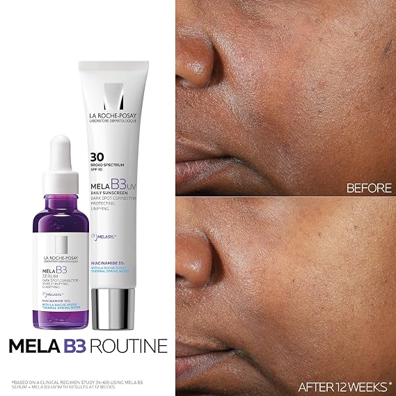 La Roche-Posay Mela B3 Serum, Dark Spot Corrector With Anti-Aging Melasyl + 10% Niacinamide, Discoloration Correcting Face Serum for Sun Spots, Age Spots & Post-Acne Marks, Lightweight Texture