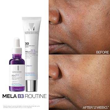 La Roche-Posay Mela B3 Serum, Dark Spot Corrector With Anti-Aging Melasyl + 10% Niacinamide, Discoloration Correcting Face Serum for Sun Spots, Age Spots & Post-Acne Marks, Lightweight Texture