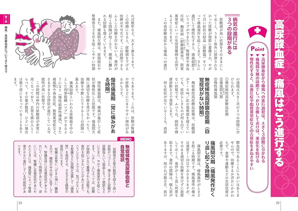 Amazon.co.jp: 患者のための最新医学 痛風・高尿酸血症 改訂版