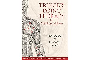 Unlock Myofascial Pain: Transformative Relief Through Trigger Point Therapy