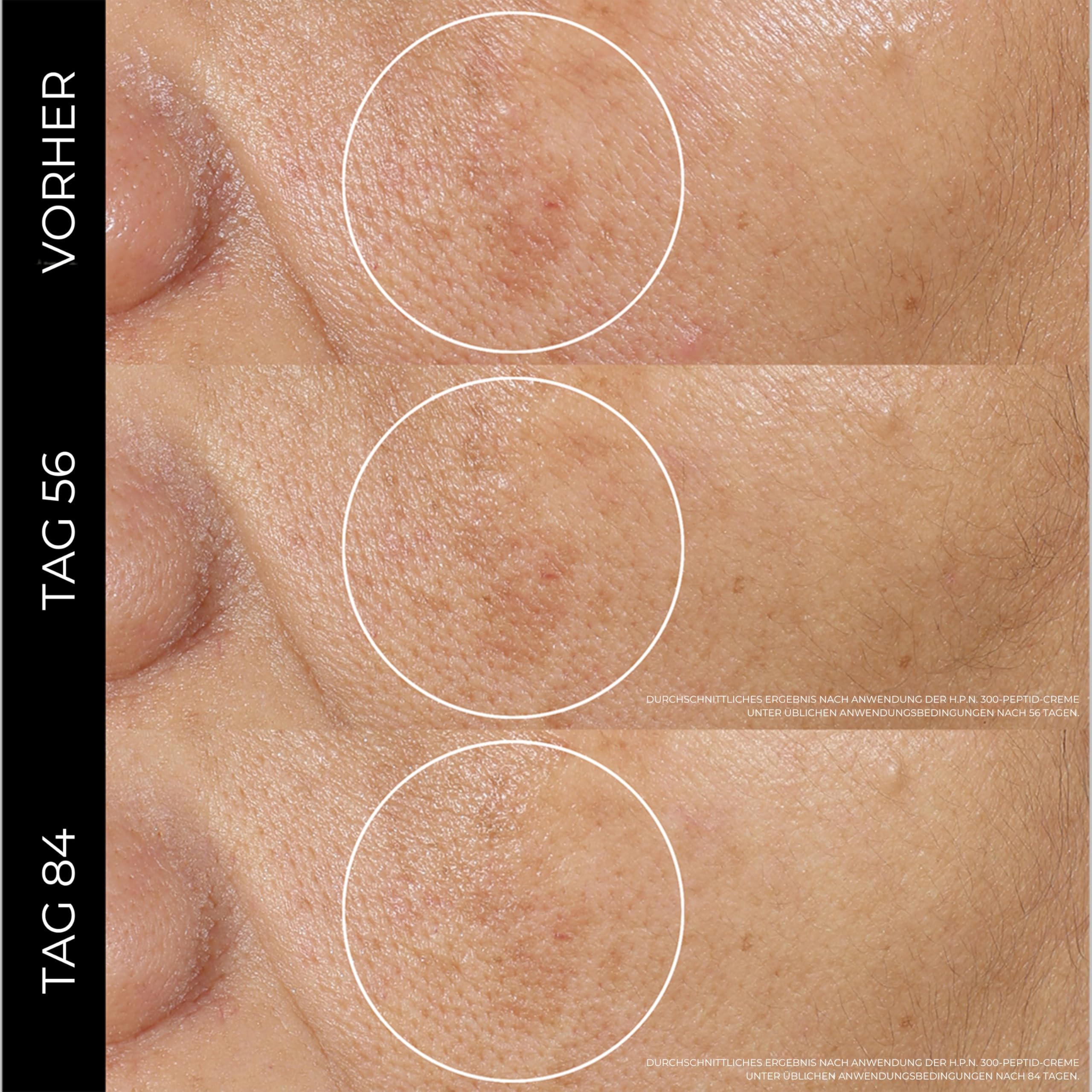 Lancôme Rénergie H.P.N. 300-Peptide Cream, Anti-Aging Gesichtscreme | regeneriert mit Hyaluronsäure, Peptiden und Niacinamid, straffend, für glattere, festere Haut