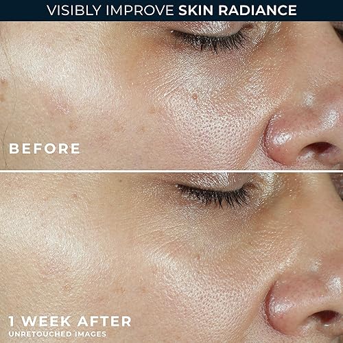 Miniatura 5 de RoC Multi Correxion Revive + Glow - Hidratante con vitamina C y FPS 30 de amplio espectro (1.7 onzas) con muestra de crema para ojos con retinol