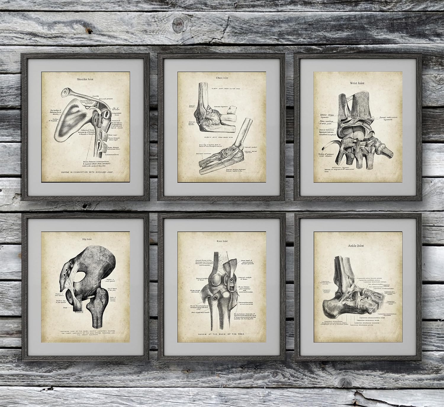 Medical Decor set of 6 unframed Orthopedic Posters of Human Anatomy Joints Wall Decor Gift for Orthopedic Surgeon, Physical Therapist, Chiropractor, Orthopedic Doctor Office Wall Art.
