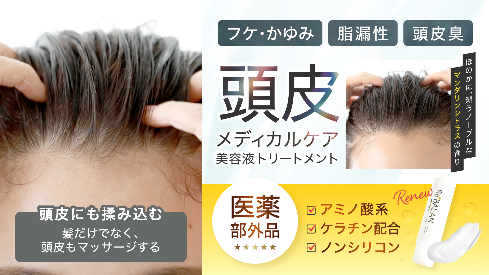 Amazon.co.jp: 【医薬部外品】頭皮に揉み込む アミノ酸 ノンシリコン