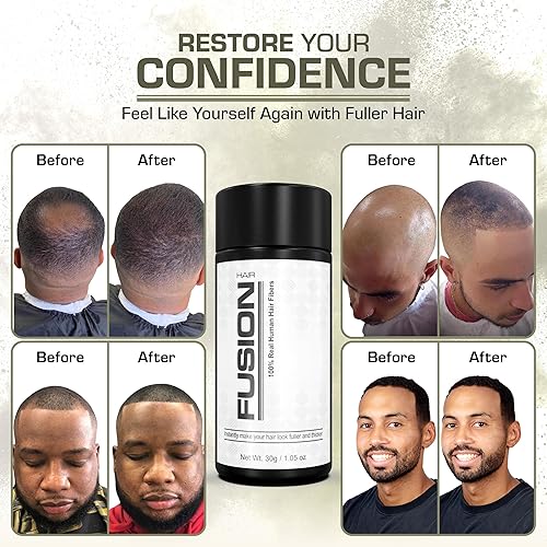 Miniatura 6 de HAIR FUSION - Fibras de cabello humano 100% reales, oculta el cabello calvo y adelgazante, retoque de raíz, voluminizador, unisex (1.05 oz, marrón)