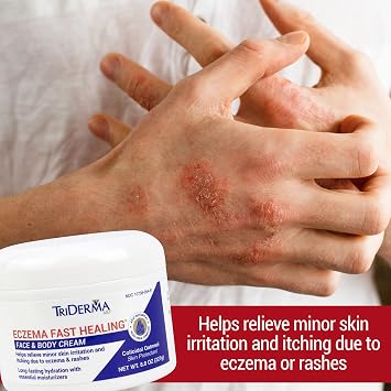 TriDerma Fast Healing Eczema Cream Colloidal Oatmeal & Aloe | Itch Relief & Moisturizer for Dry, Irritated Skin | Eczema & Rashes, No Fragrance, 8 oz jar | Sensitive Skin Moisturizer