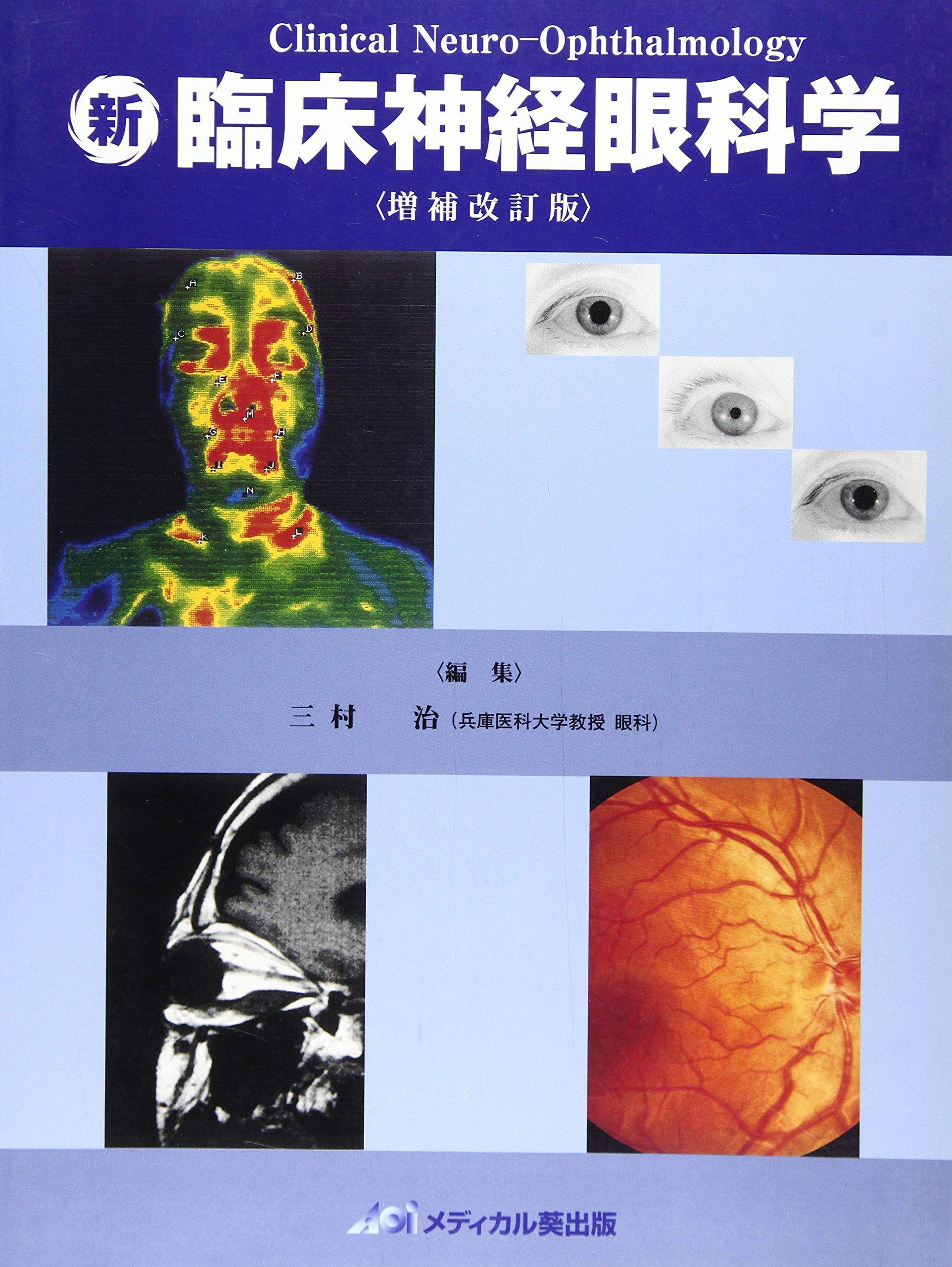 臨床神経眼科学 Amazon.co.jp: 新臨床神経眼科学 : 三村治: Japanese Books
