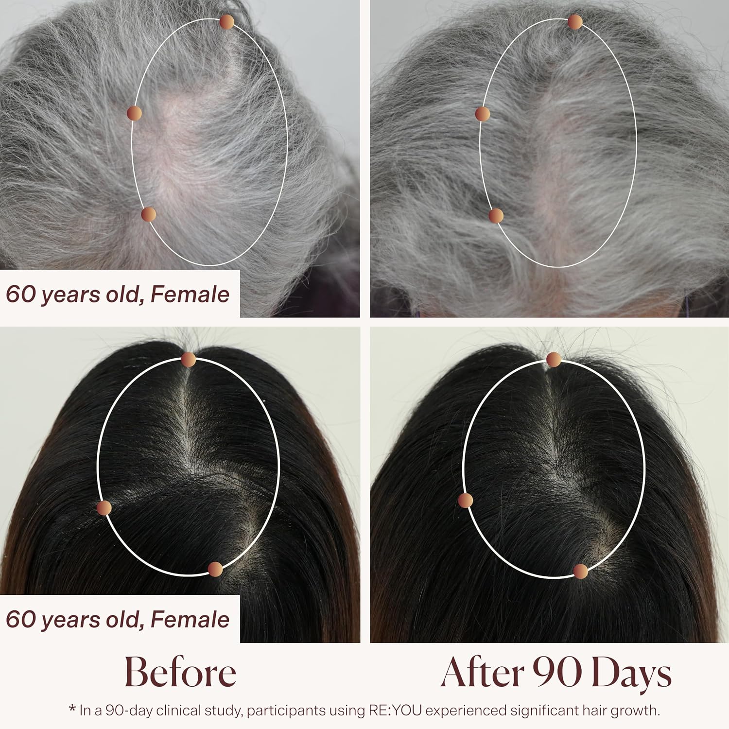 RE:YOU Dual-Path Hair Revival Serum for Thinning Hair | Supports Fuller, Healthier-Looking Hair, Nourishes Hair Follicles & Scalp with NOVOGRO™ Biotechnology