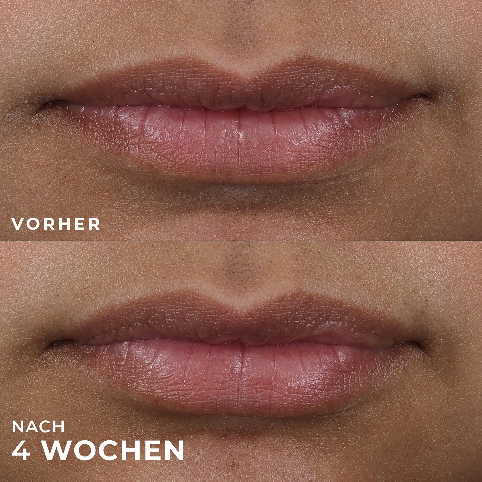 RoC Derm Correxion Lip Volumizer | Lippenbalsam mit Hyaluronsäure & Kollagenpeptiden | 10 ml
