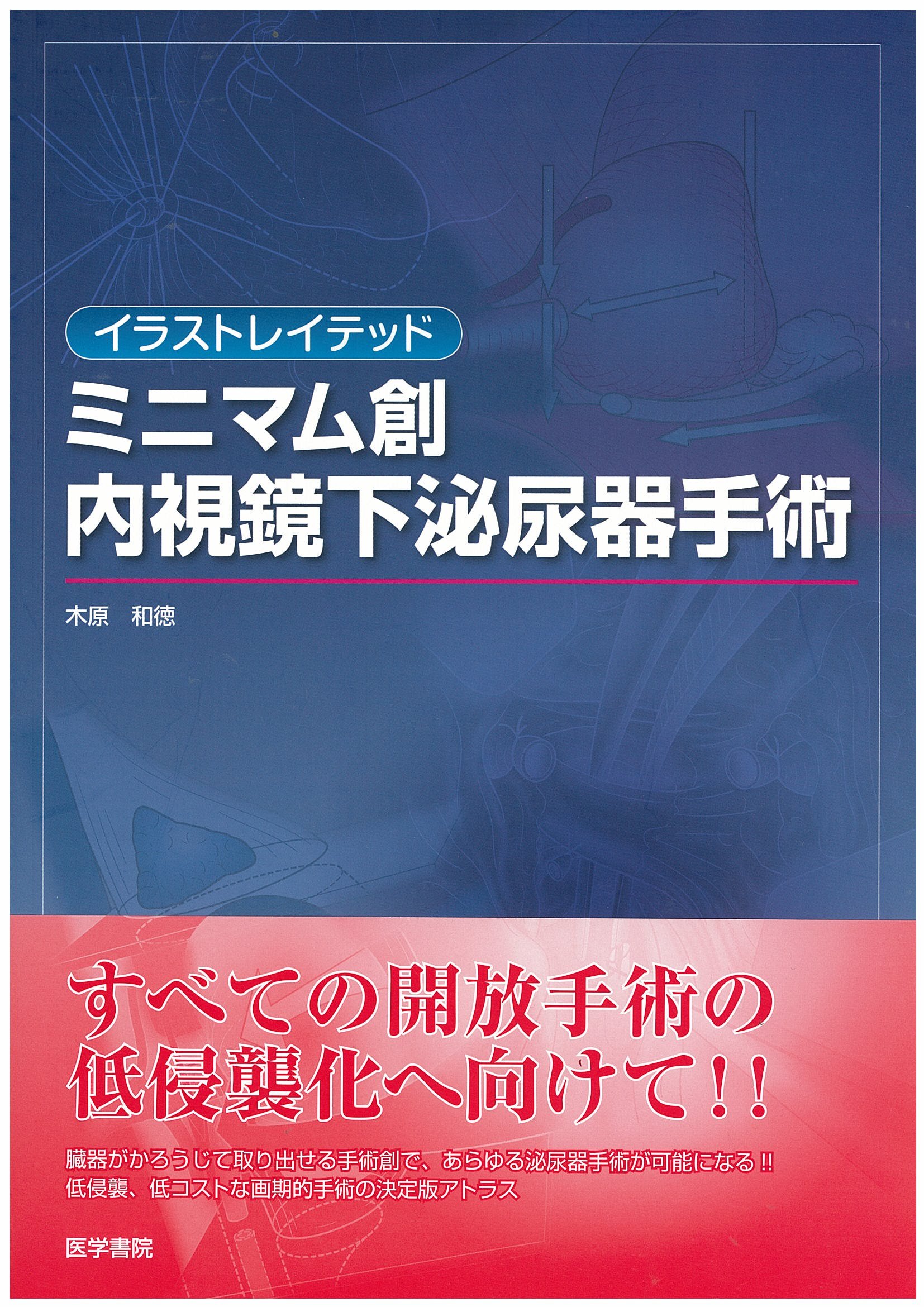 Amazon.co.jp: イラストレイテッドミニマム創内視鏡下泌尿器手術 : 本
