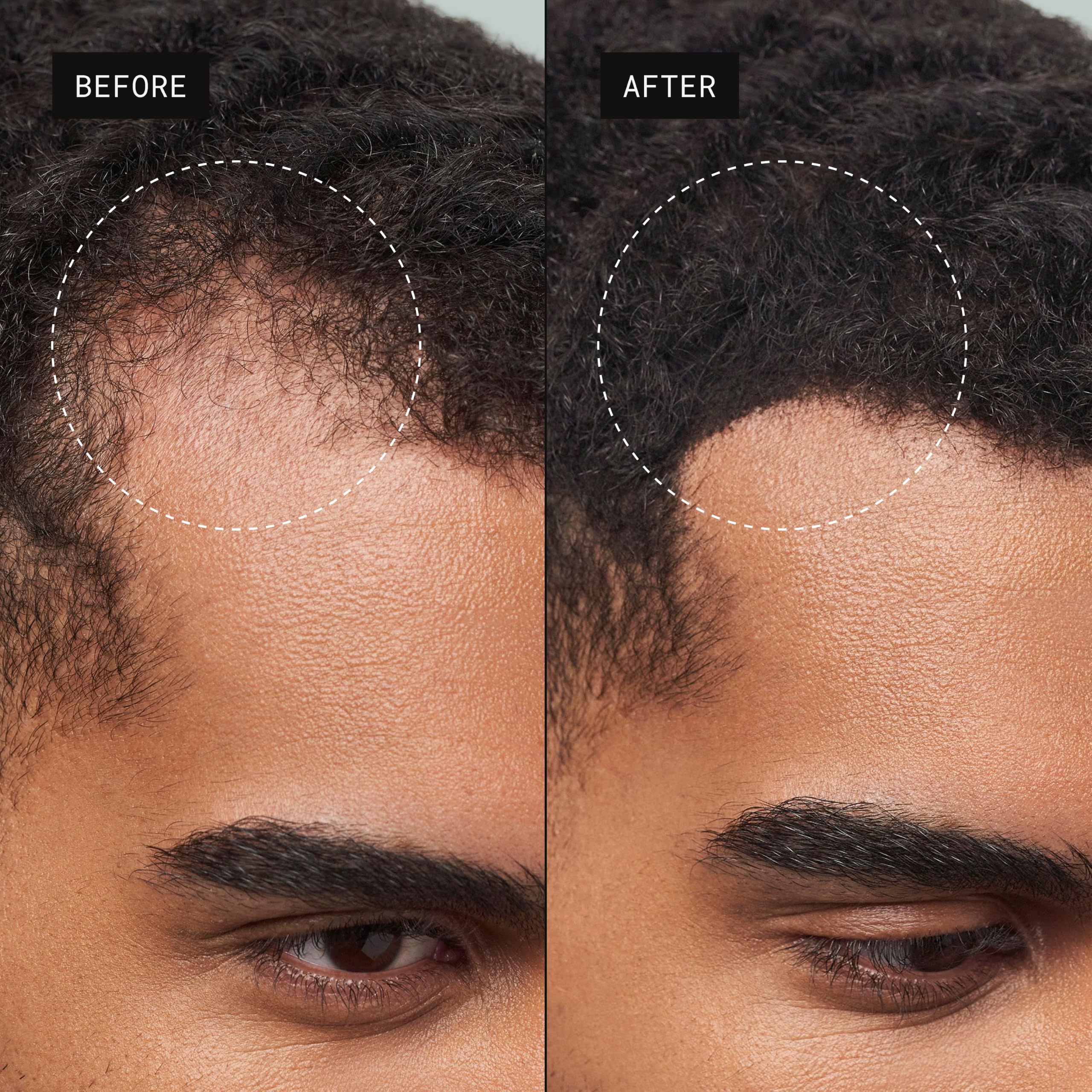 Toppik Haarfasern zur Haarverdichtung, Ansatzpuder und Streuhaar für Haarausfall und sofort volleres Haar, kaschiert lichte Stellen, natürlicher Look, einfach anzuwenden, Dunkelbraun, 55g