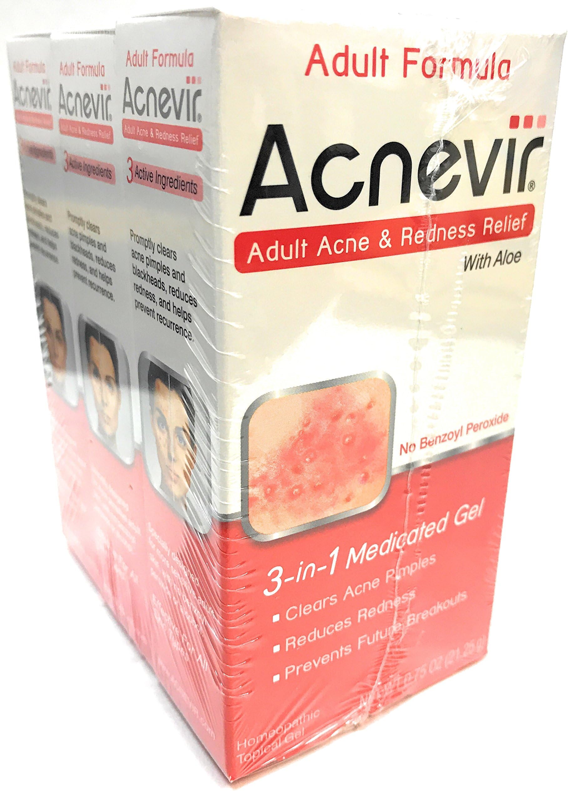 Acnevir Adult Acne & Redness Relief Gel, 0.75 Ounce (3-Pack)