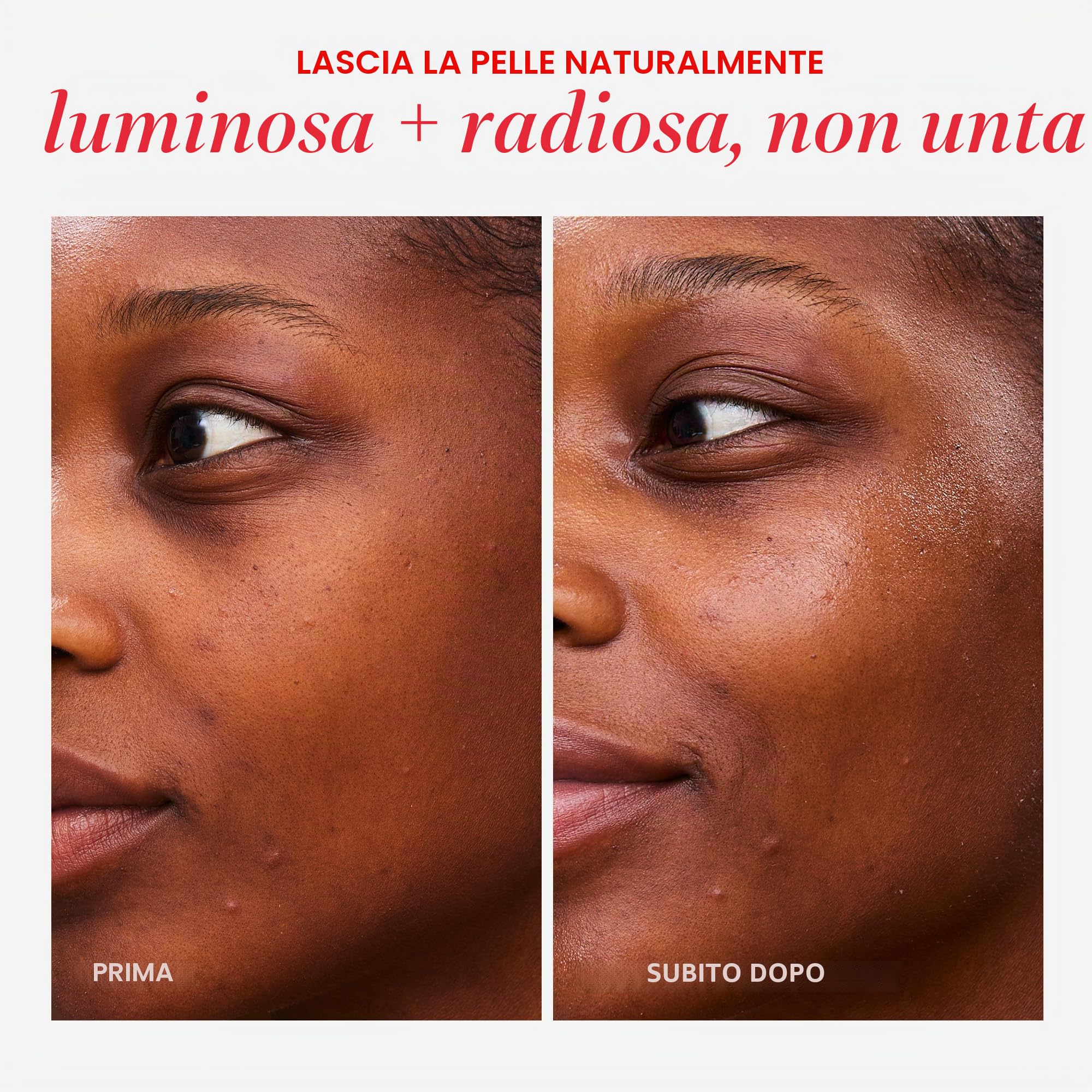 First Aid Beauty - Crema gel idratante Dewy, idratante viso leggero senza olio con acido ialuronico e ceramidi, aiuta a ridurre l'accumulo di olio in eccesso e migliorare l'idratazione della pelle