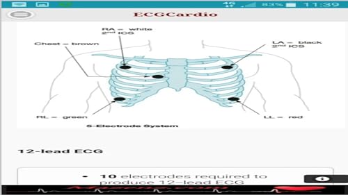 ECGCardio