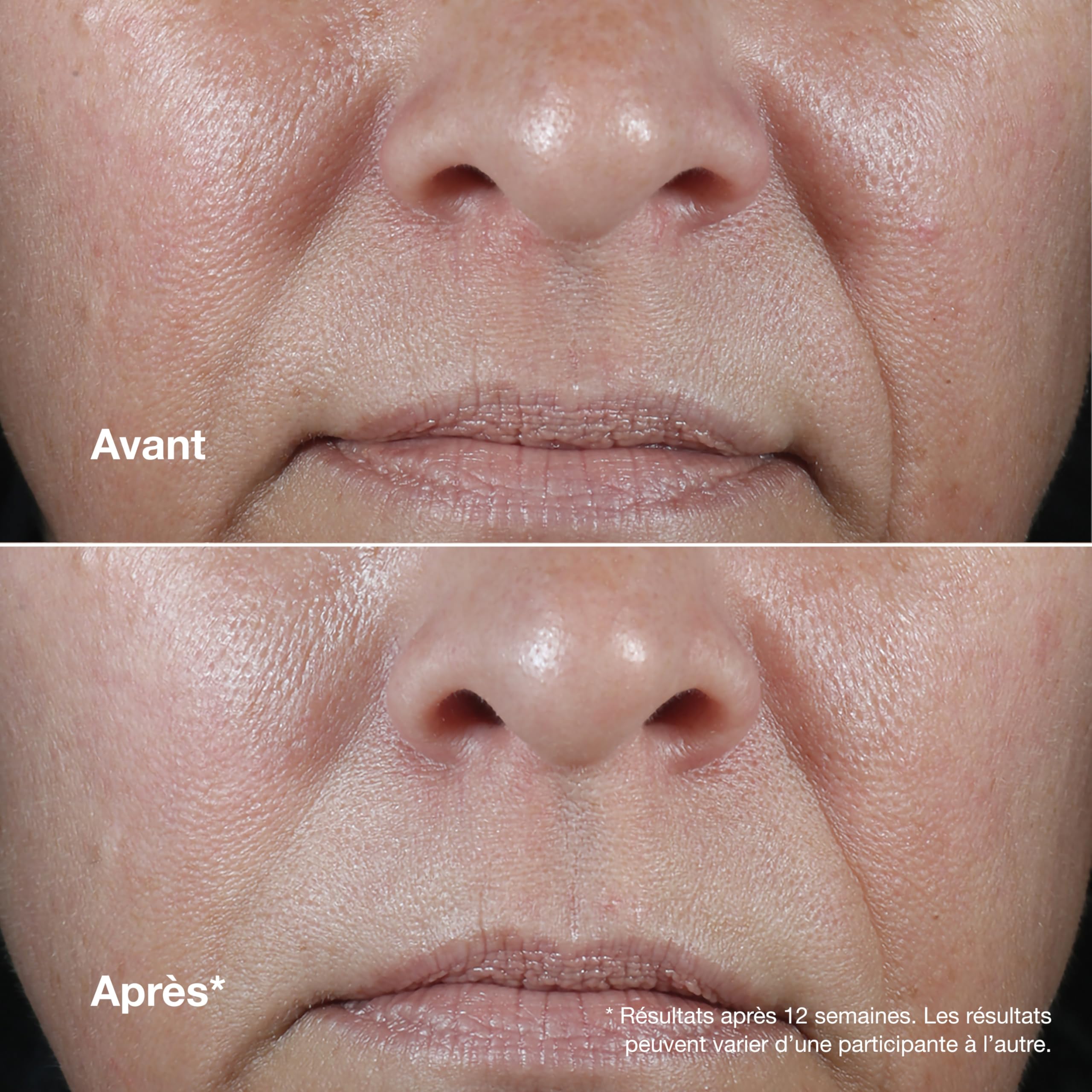Clinique Smart Clinical Repair Crème Visage Correctrice Anti-Rides à l'Acide Hyaluronique + Peptides | Anti-Âge + Hydratante