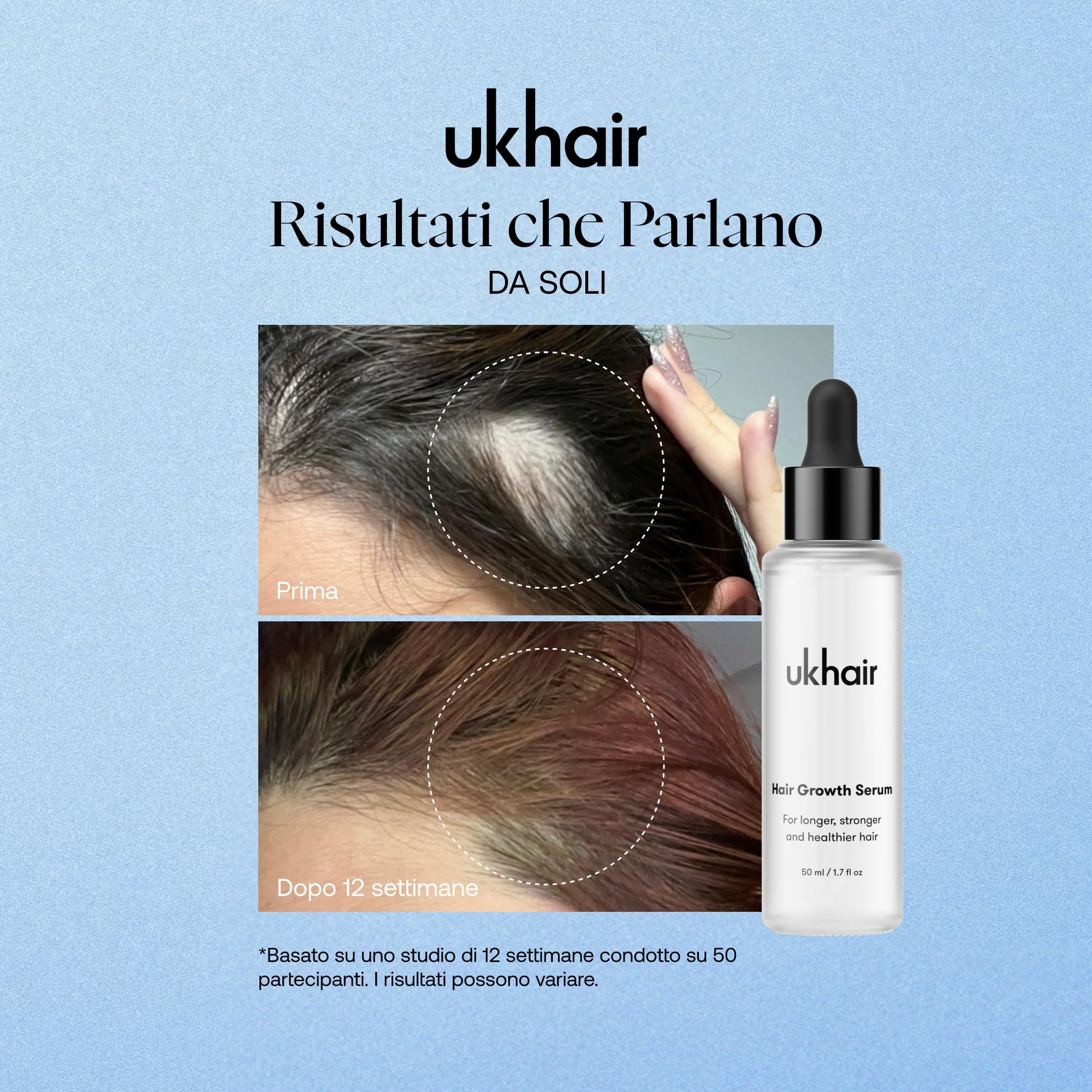 UKLASH Siero rivitalizzante per capelli per uomini e donne, favorisce lo spessore dei capelli diradati e la caduta dei capelli, clinicamente testato, leggero e ad assorbimento rapido