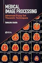 Medical Image Processing: Advanced Fuzzy Set Theoretic Techniques