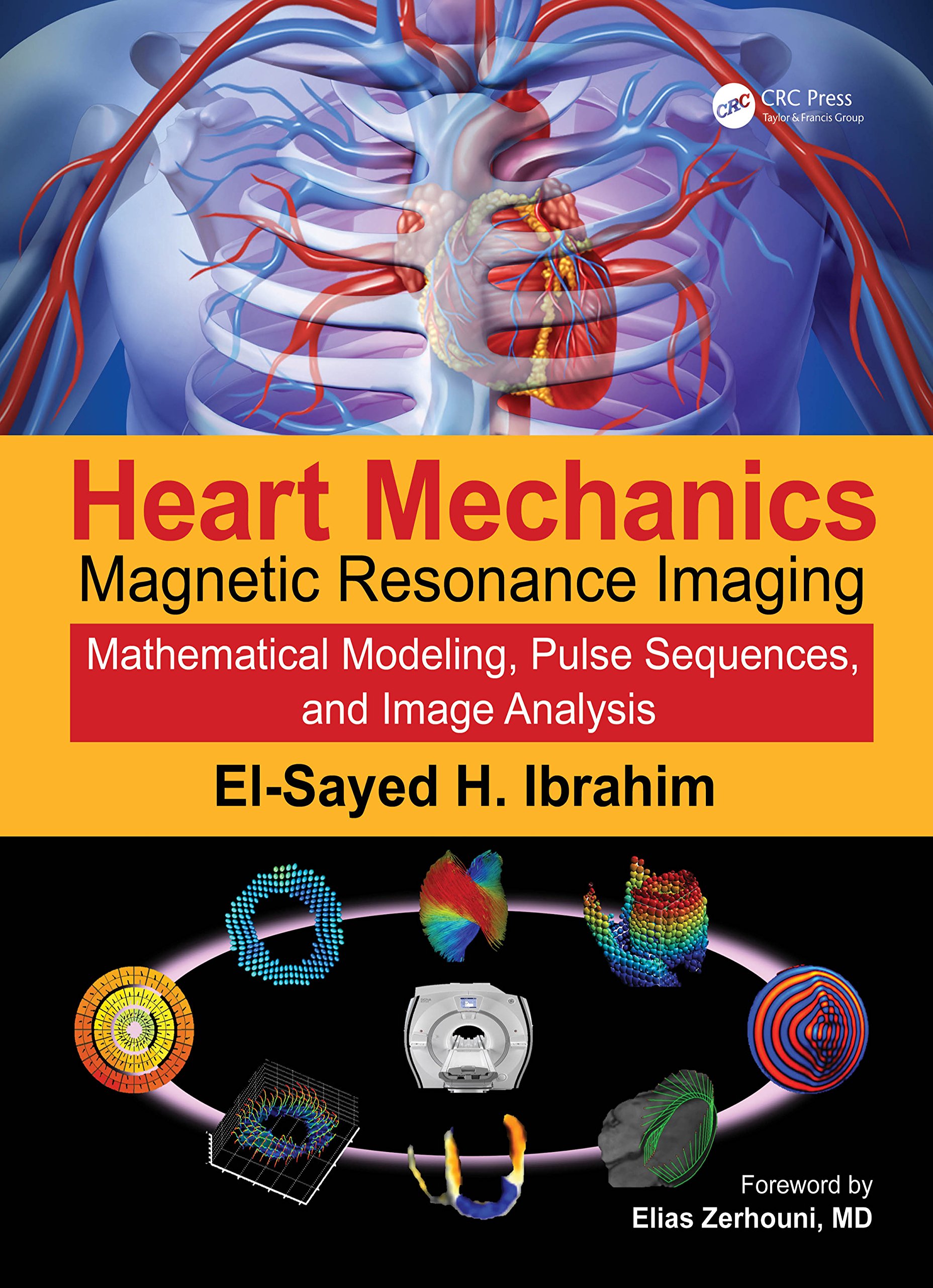 Heart Mechanics: Magnetic Resonance ImagingMathematical Modeling, Pulse Sequences, and Image Analysis