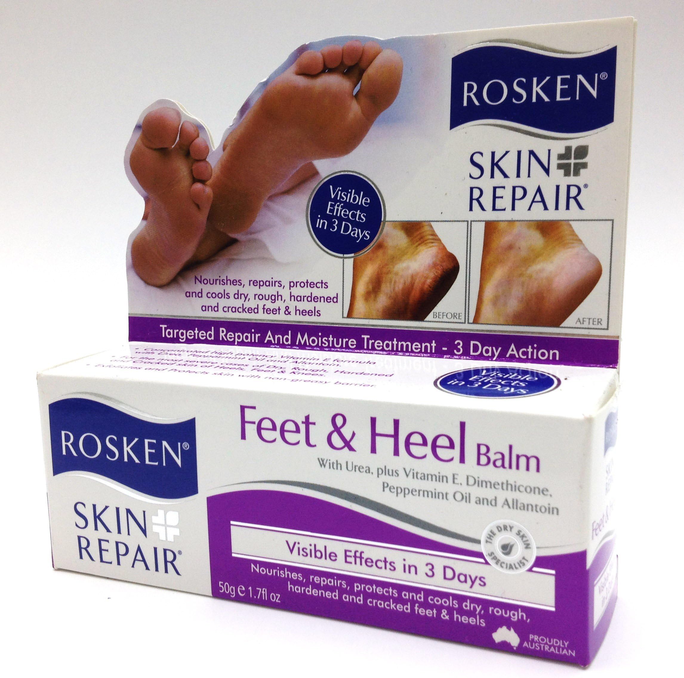 Rosken Feet and Heel Balm 50g,for Cracked Heel & Dry Feet