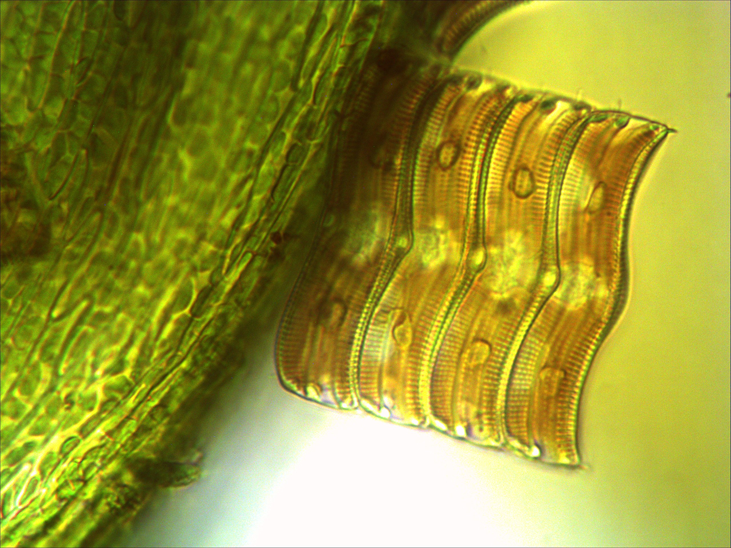 Bresser 5760100 Science TRM 301 Microscopio | Illuminazione Köhler trasmessa, Tubo fotografico trinoculare, Tavolino meccanico, Condensatore Abbe, Fuoco macro e fine