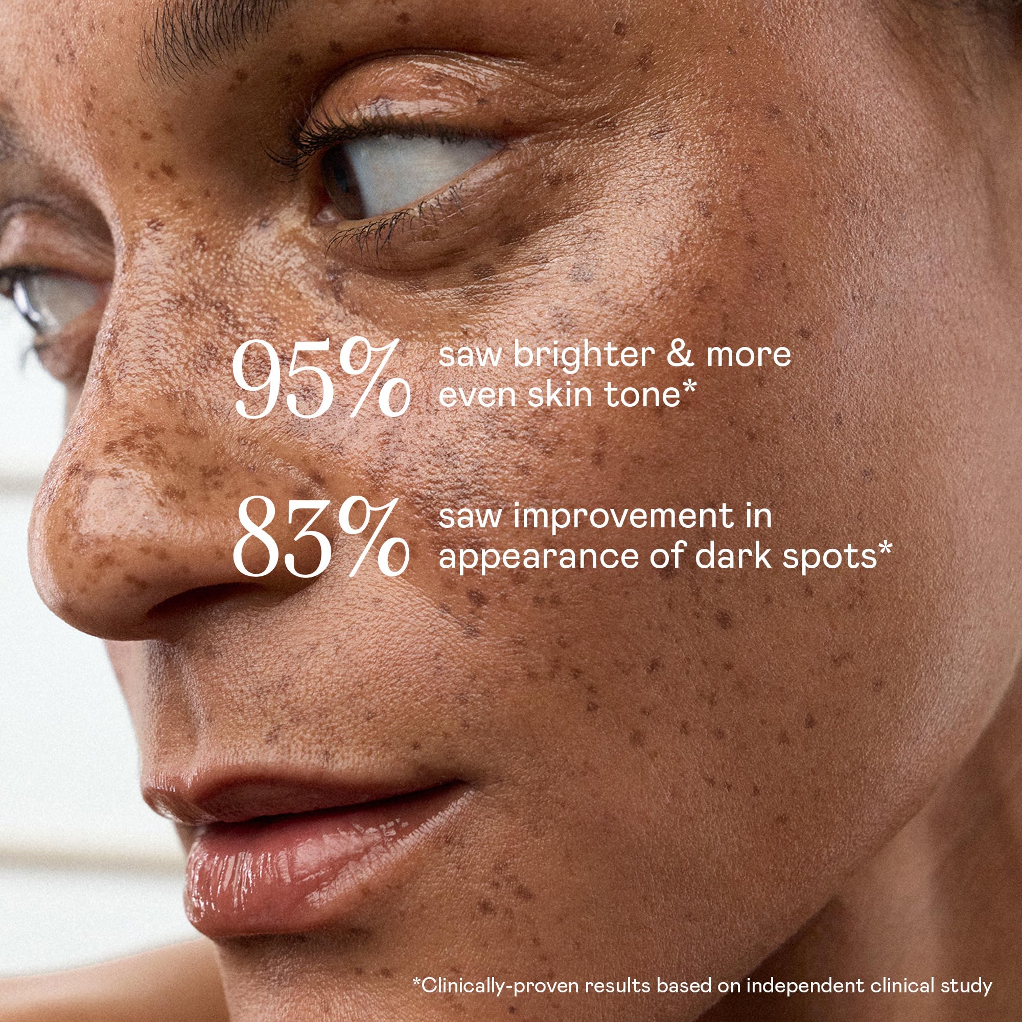 NuFACE Super Vita-C Booster - Vitamin C Gesichtsserum mit Niacinamid - für einen gleichmäßigen Hautton, gegen dunkle Flecken - optimiert Mikrostrom-Behandlungen mit dem (30 ml)