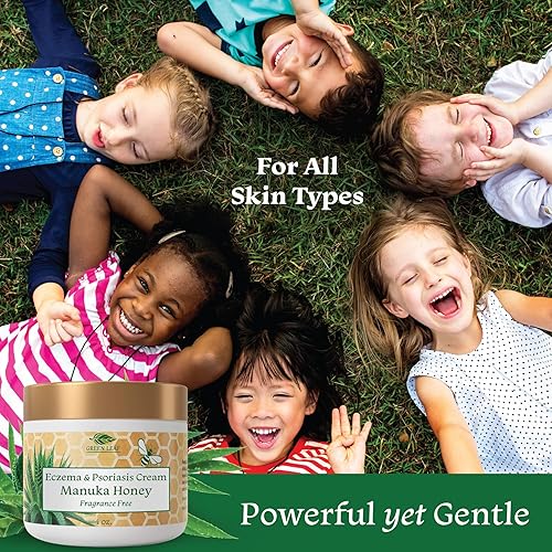Miniatura 5 de Manuka Honey Eczema Cream Loción hidratante sin fragancia para aliviar la psoriasis - Pomada para erupciones cutáneas secas y con picazón -