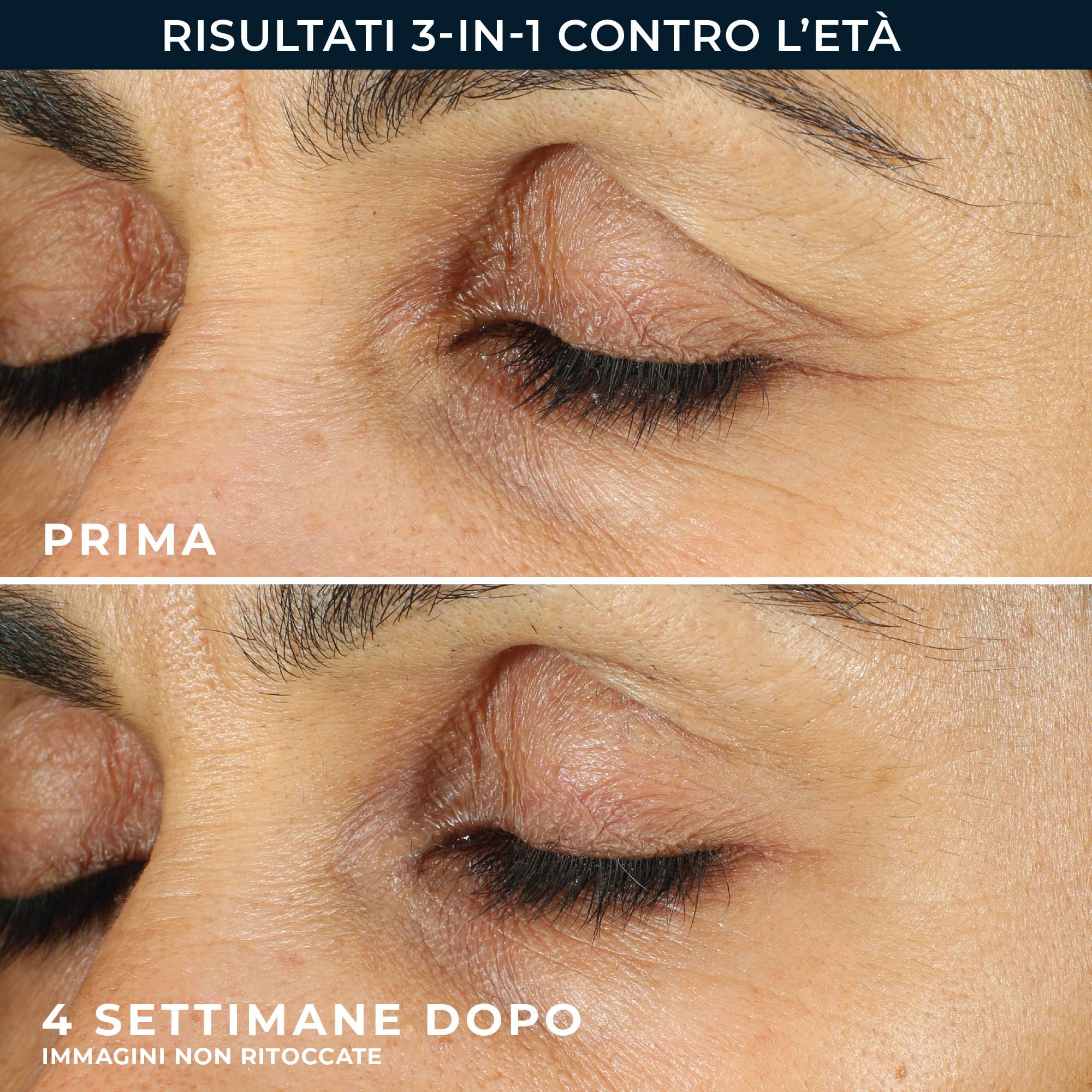 RoC - Retinol Correxion Line Smoothing Crema Contorno Occhi - Riduce Visibilmente Gonfiori e Occhiaie - Antirughe e Antietà - 15 ml