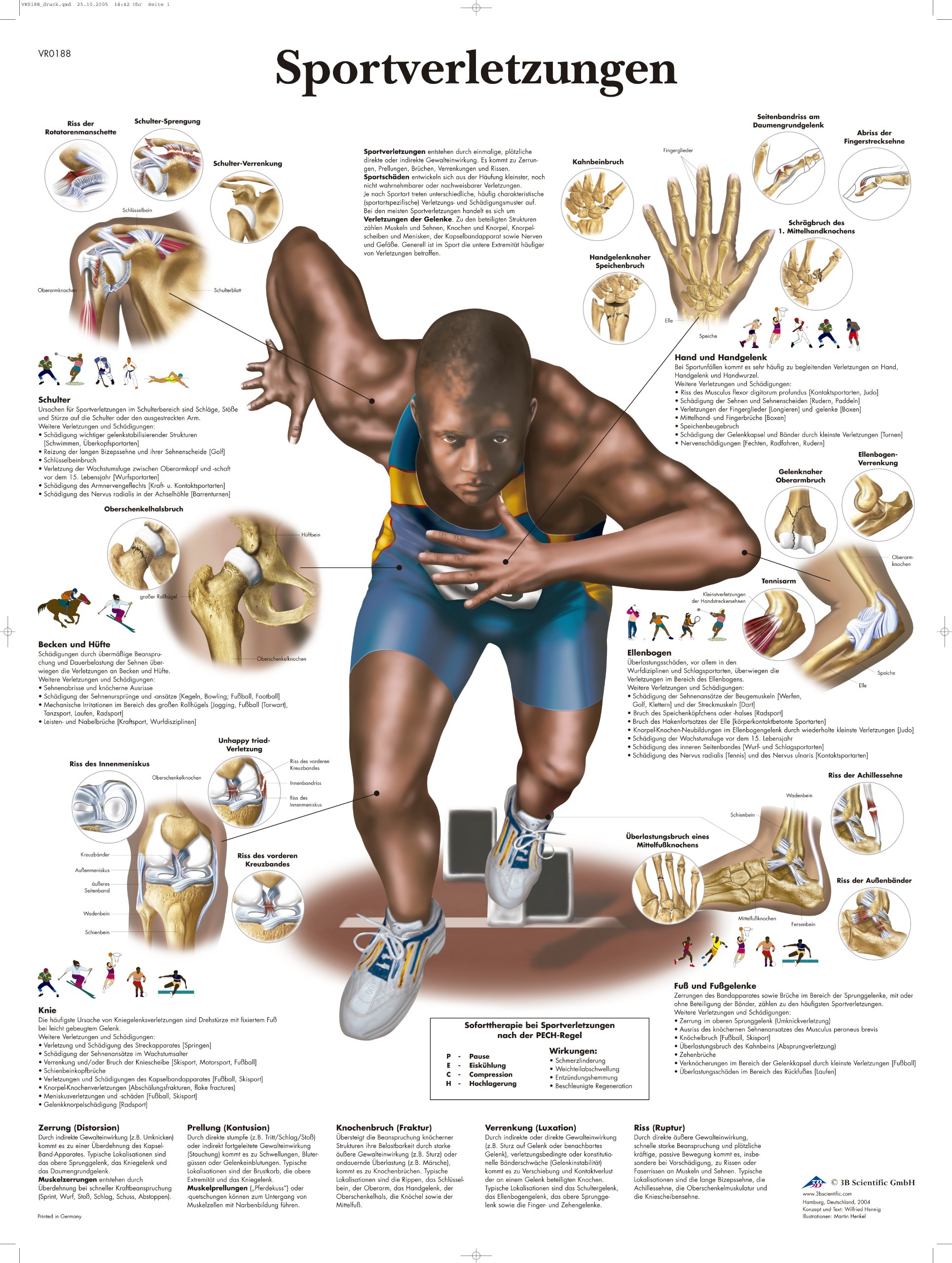 3B Scientific Teaching Chart - ‘Sportverletzungen’, VR0188UU
