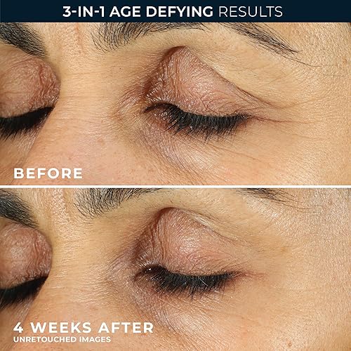 Miniatura 6 de RoC Retinol Correxion Eye Cream Mini para ojeras e hinchazón, crema diaria antiarrugas, línea antienvejecimiento suavizante tratamiento para el