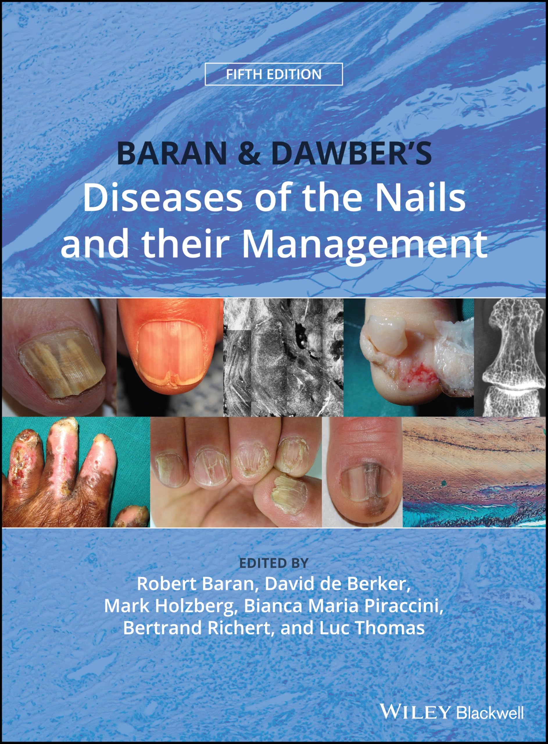 Baran & Dawber's Diseases of the Nails and their Management