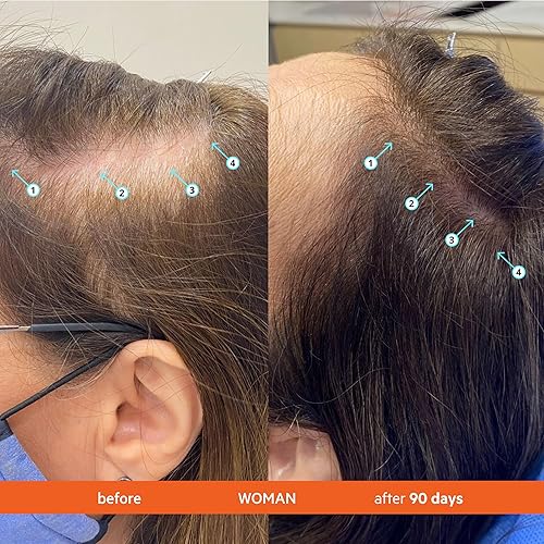 Miniatura 4 de DS Labs Revita Shampoo & Spectral Kit de suero para hombre  Primera limpieza del cuero cabelludo y ligero sin enjuague para un aspecto más completo,