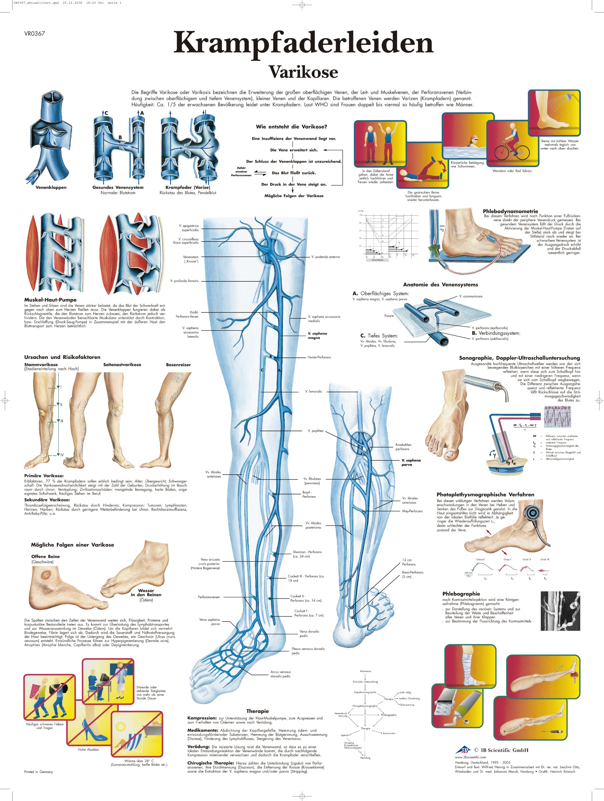 Tableau varices plastifié 3B Scientific affiche médicale haute définition - 2