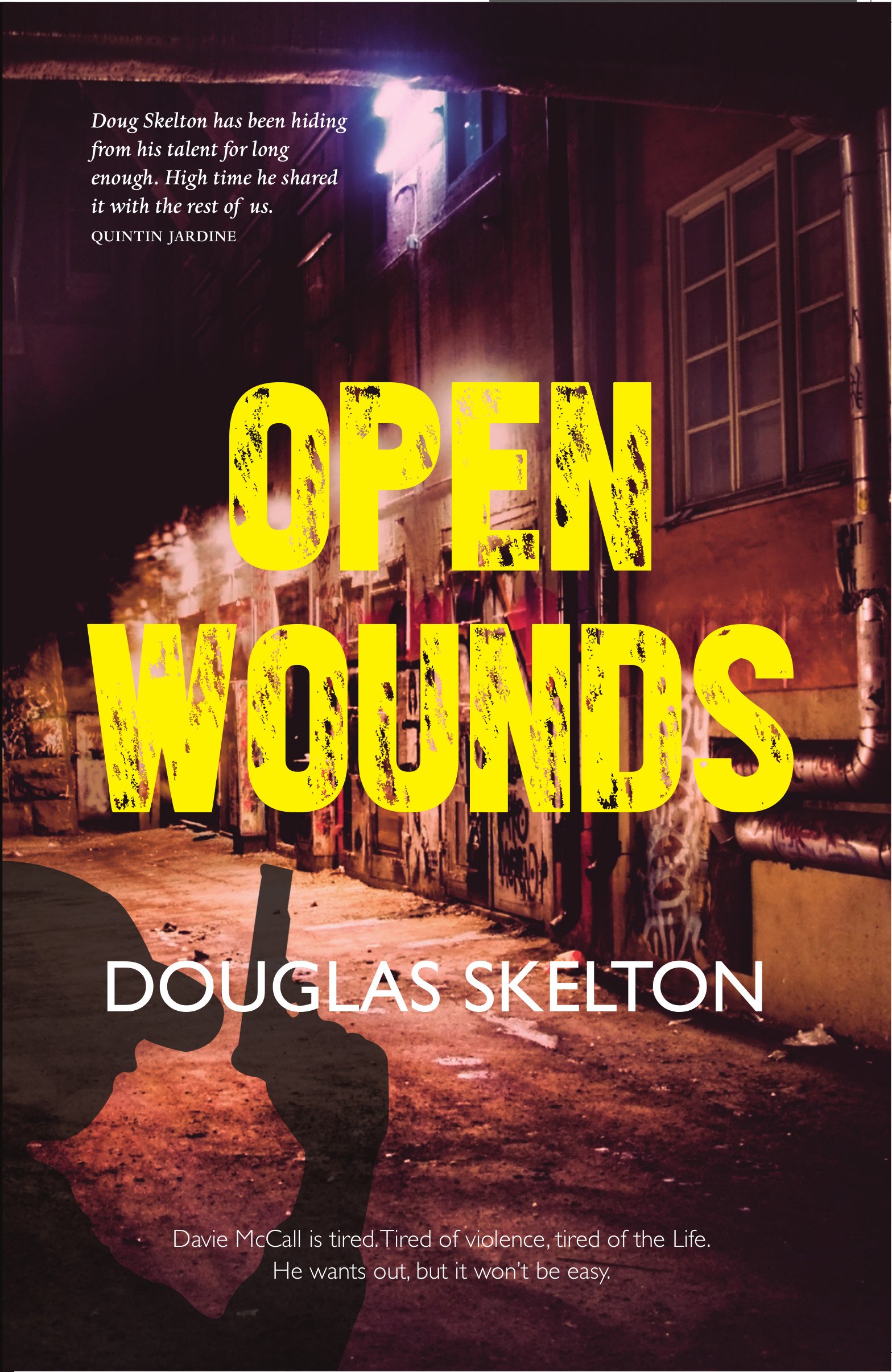 Open Wounds by Douglas Skelton PAPERBACK 9781910745335