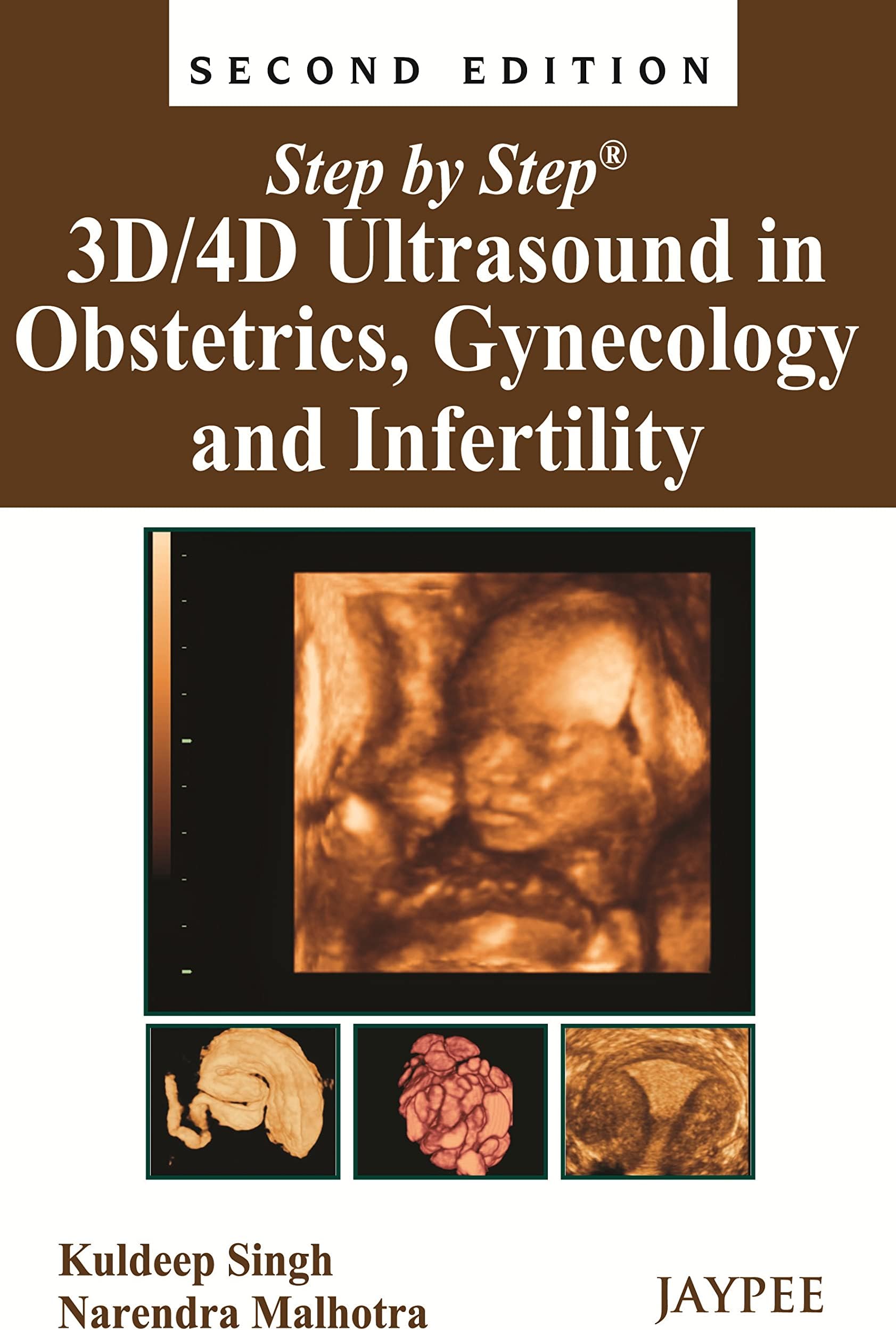 Step by Step: 3D/4D Ultrasound in Obstetrics, Gynecology and Infertility Paperback – 30 Aug. 2013