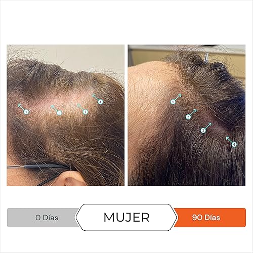 Miniatura 4 de Paquete de champú y masajeador Revita Liter