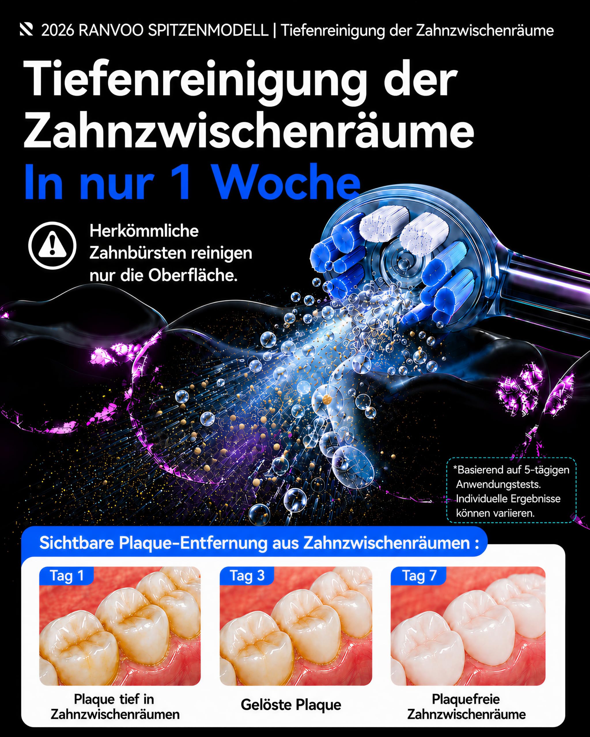 RANVOO AirJet X5 [Extra tiefe Zahnzwischenraum-Reinigung] Next-Gen elektrische Zahnbürste, 100% Plaque-Entfernung, Zahnfleischpflege, für Zahnspangen geeignet, 60 Tage Akku, 3 Bürstenköpfe, Stahlblau