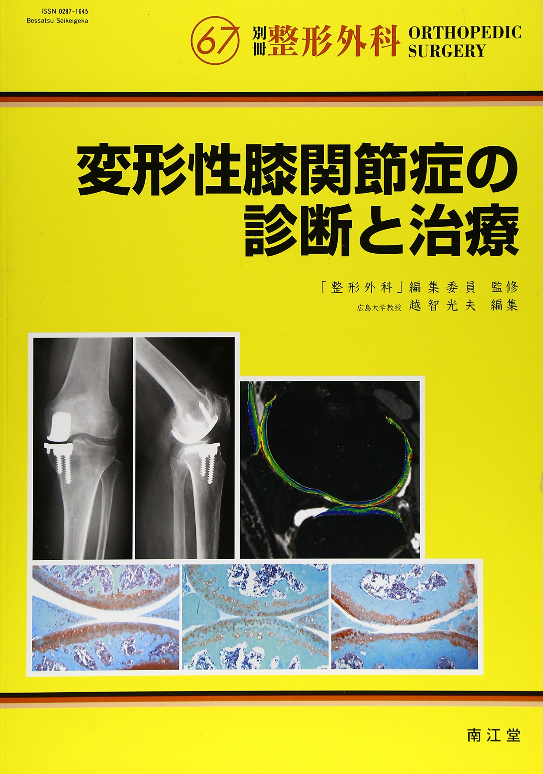 変形性膝関節症の診断と治療 | 越智光夫 |本 | 通販 | Amazon