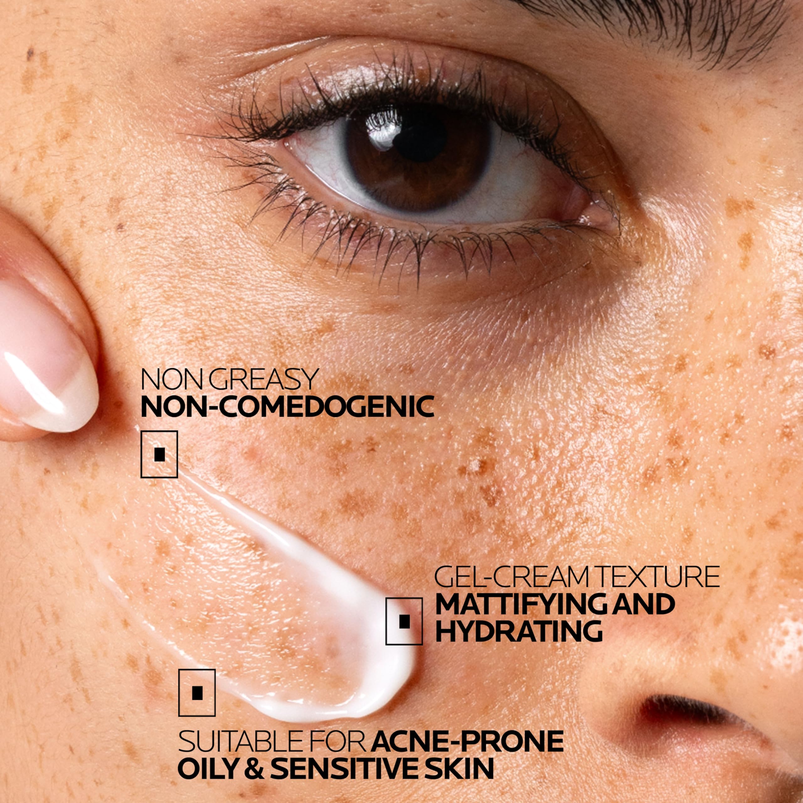 Acne Treatment