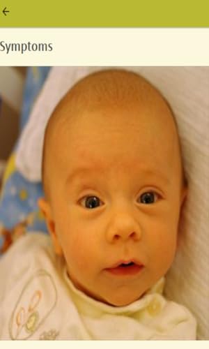 Symptoms Of Jaundice