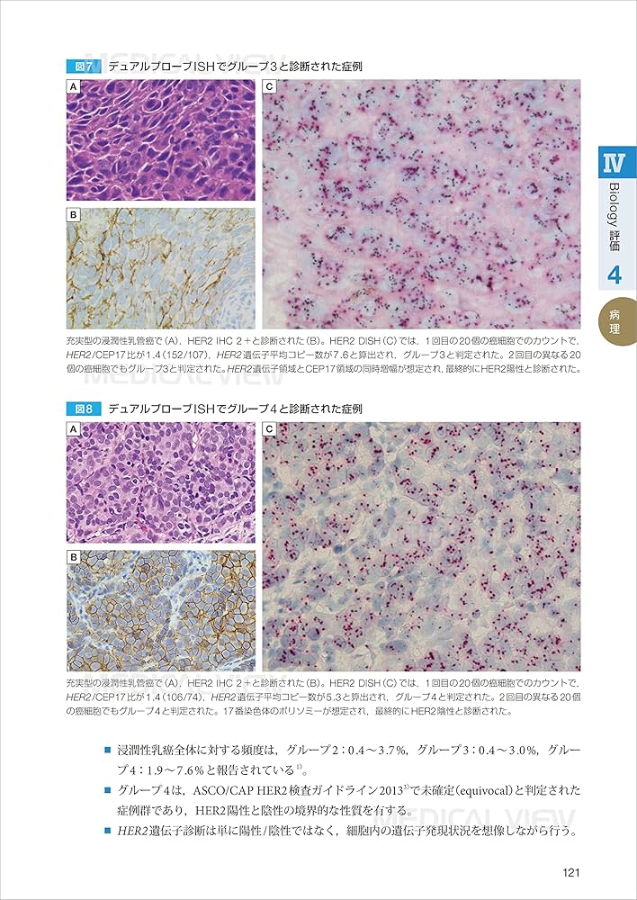 裁断済み　ケースで考える乳腺画像診断戦略 : 『画像と病理との対比』 ケースで考える乳腺画像診断戦略: 『画像と病理との対比』から