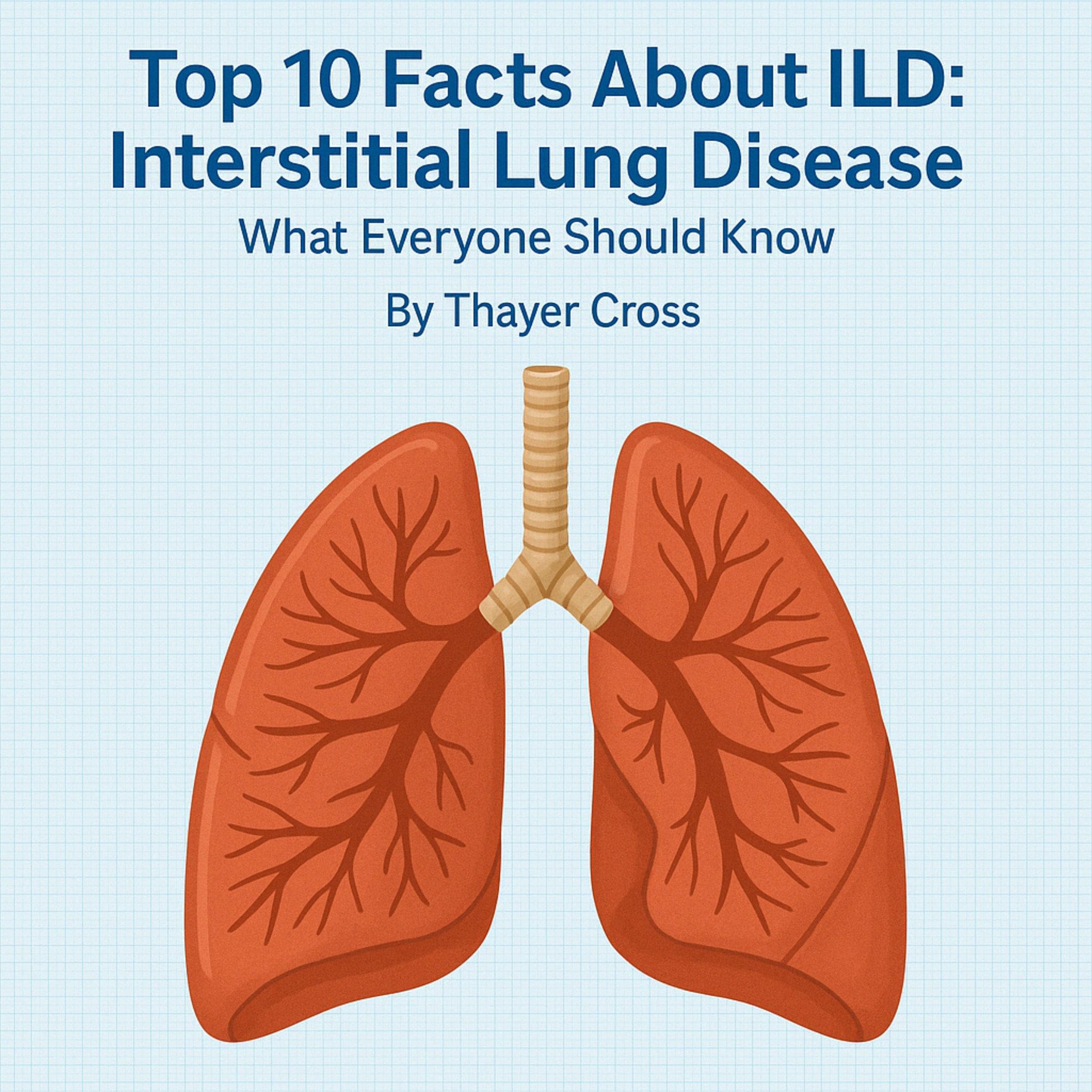 Essential Medical Facts: Top 10 Facts About Interstitial Lung Disease (ILD)
