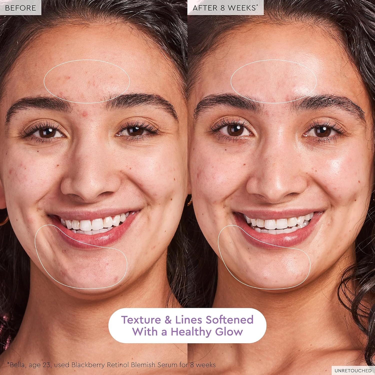 Glow Recipe Gentle Blackberry Retinol Night Serum - Anti Aging Korean Face Serum for Sensitive Skin + Hydrating Triple Retinoids & Glycerin to Clarify Blemishes, Smooth Texture, Lines & Wrinkles, 30ml - Image 3