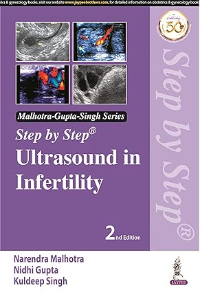 STEP BY STEP ULTRASOUND IN INFERTILITY