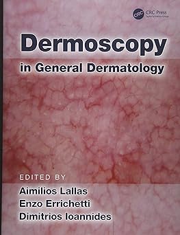 Dermoscopy In General Dermatology (Hb 2018)