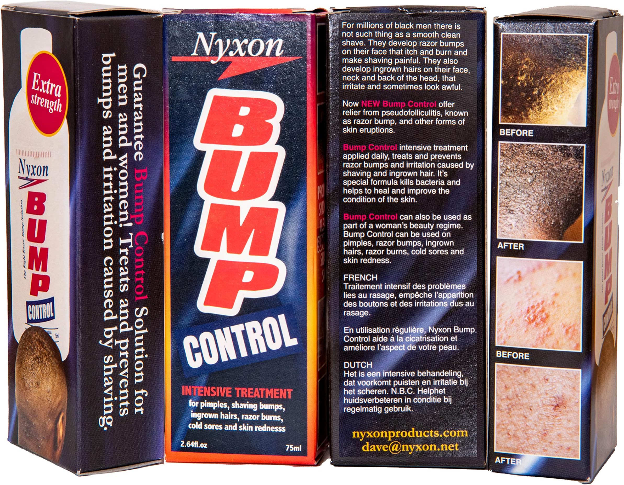 Nyxon Bump Control 75 ml/2.64 fl oz by Nyxon