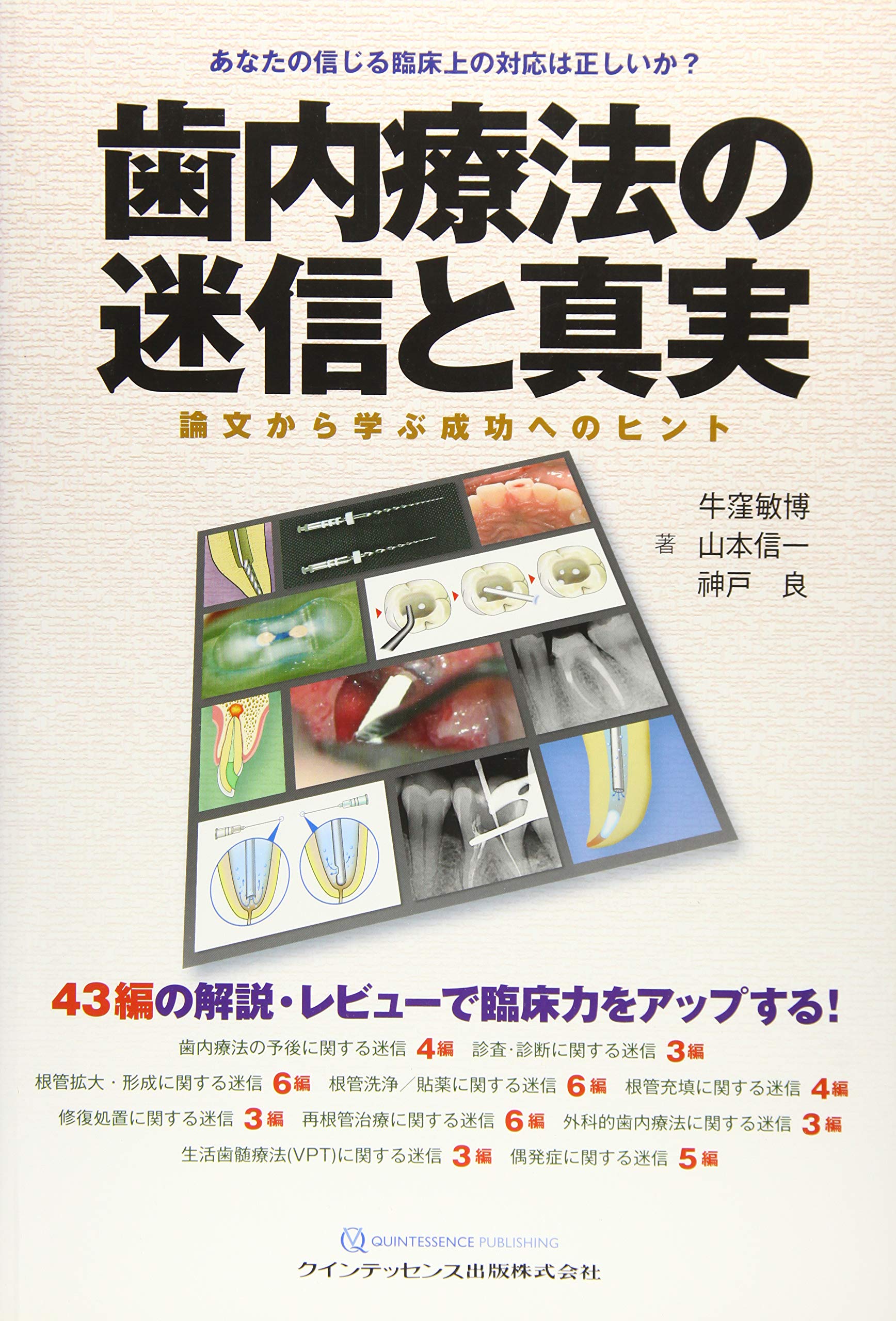 気内療法学 5冊セット Amazon.co.jp: スピード解決! 歯内療法Q&A(全5巻セット