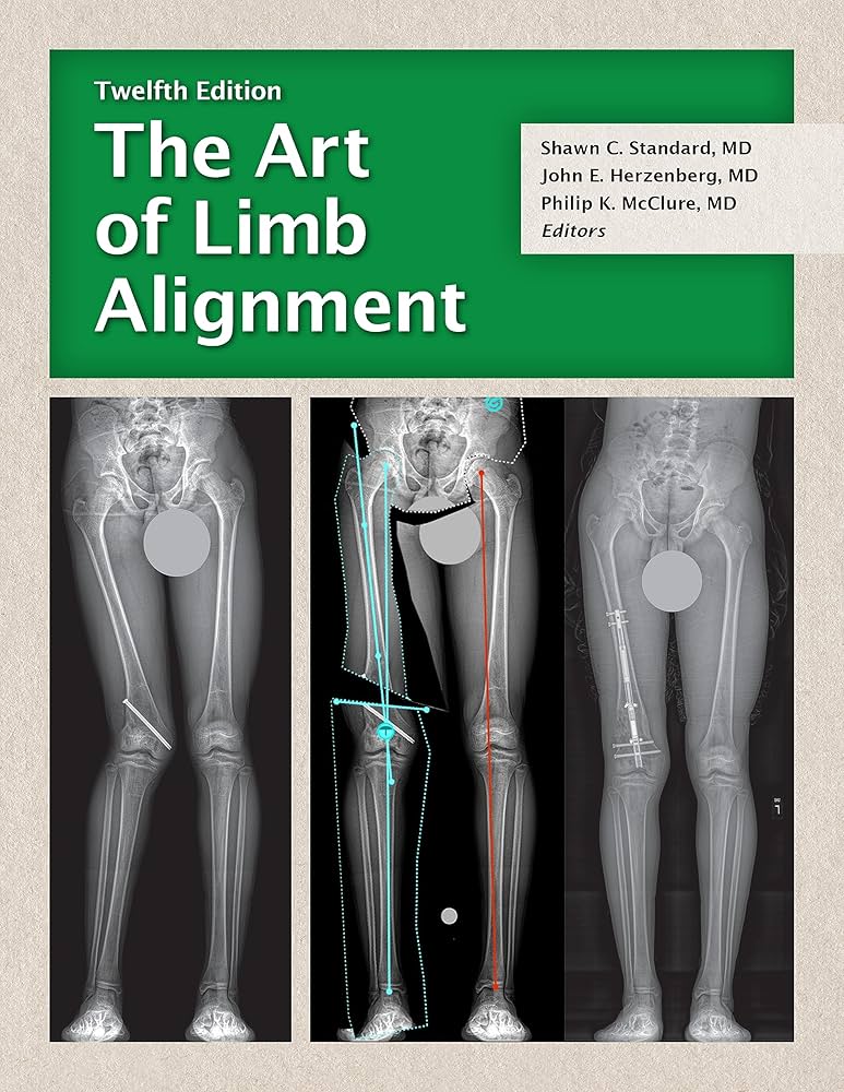 健康・医学 The Art of Limb Alignment, 12th Edition Amazon.com: The Art of Limb Alignment, Twelfth Edition eBook