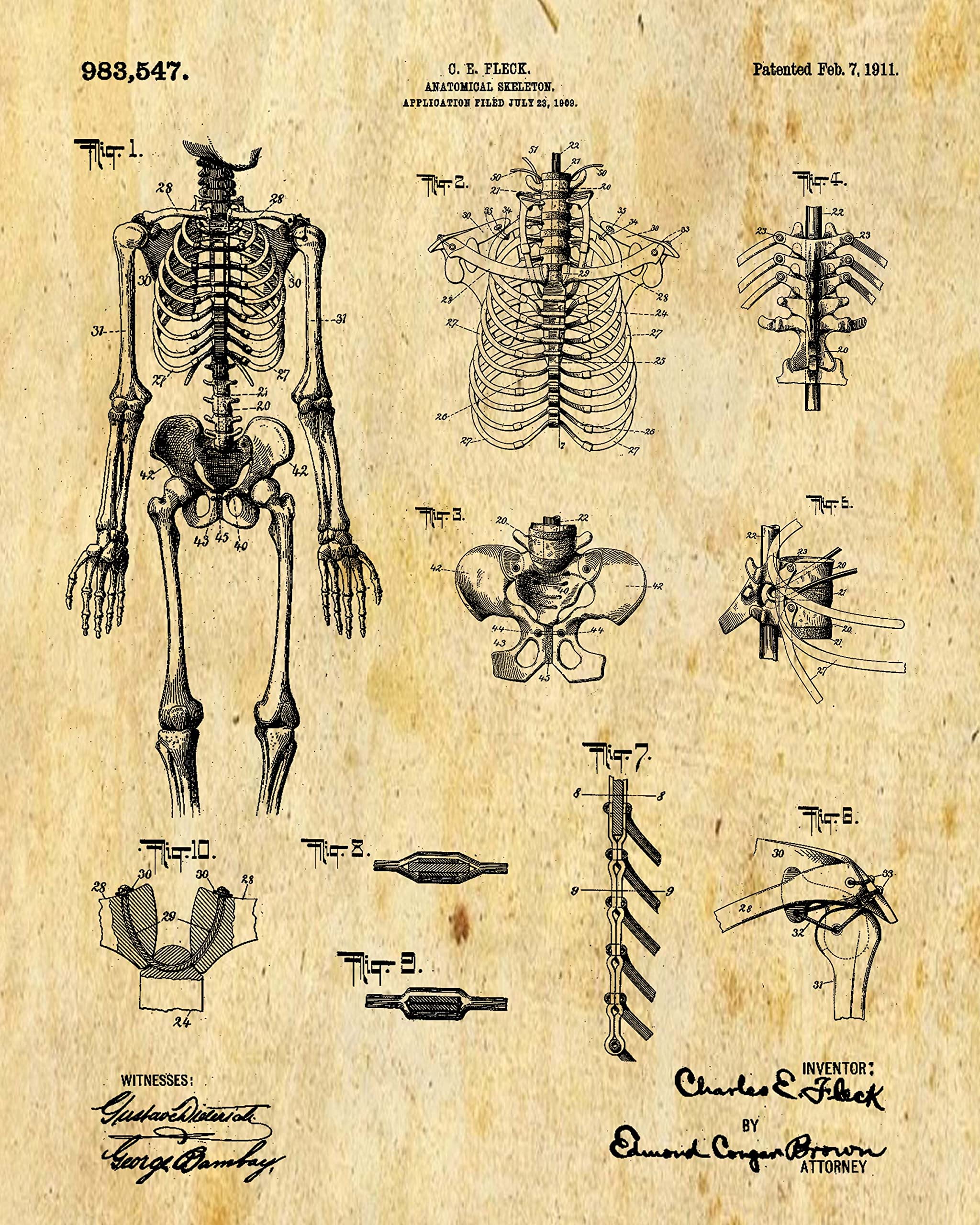Amazon.com: Vintage Medicine Wall Art Patent Prints - Set of 6